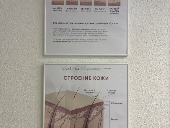 Эпилз, интерьер