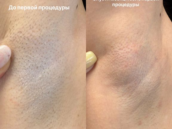 IP_Laser, интерьер