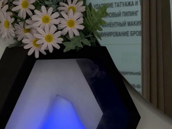 PalmaLaser, интерьер