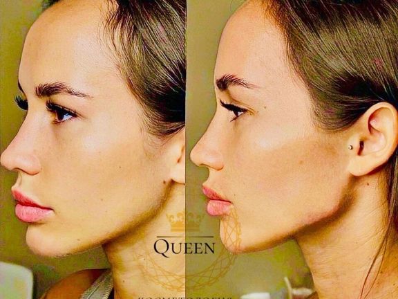 Queen, интерьер