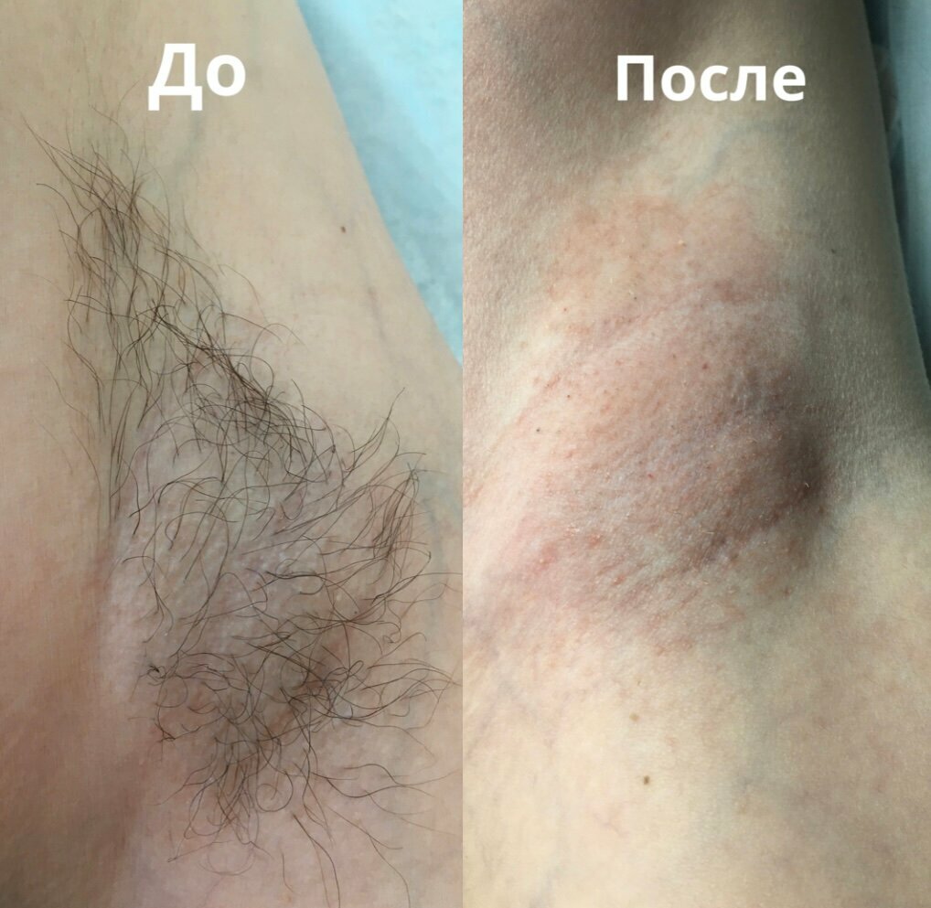 Гладкость